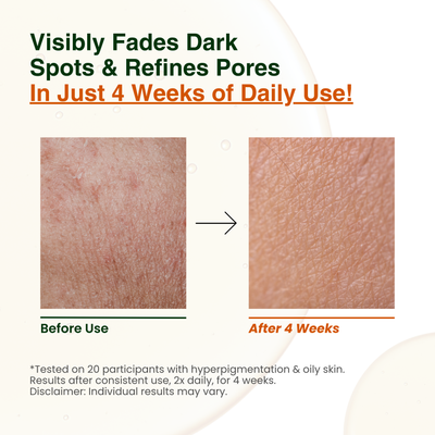 Choglow Face Oil